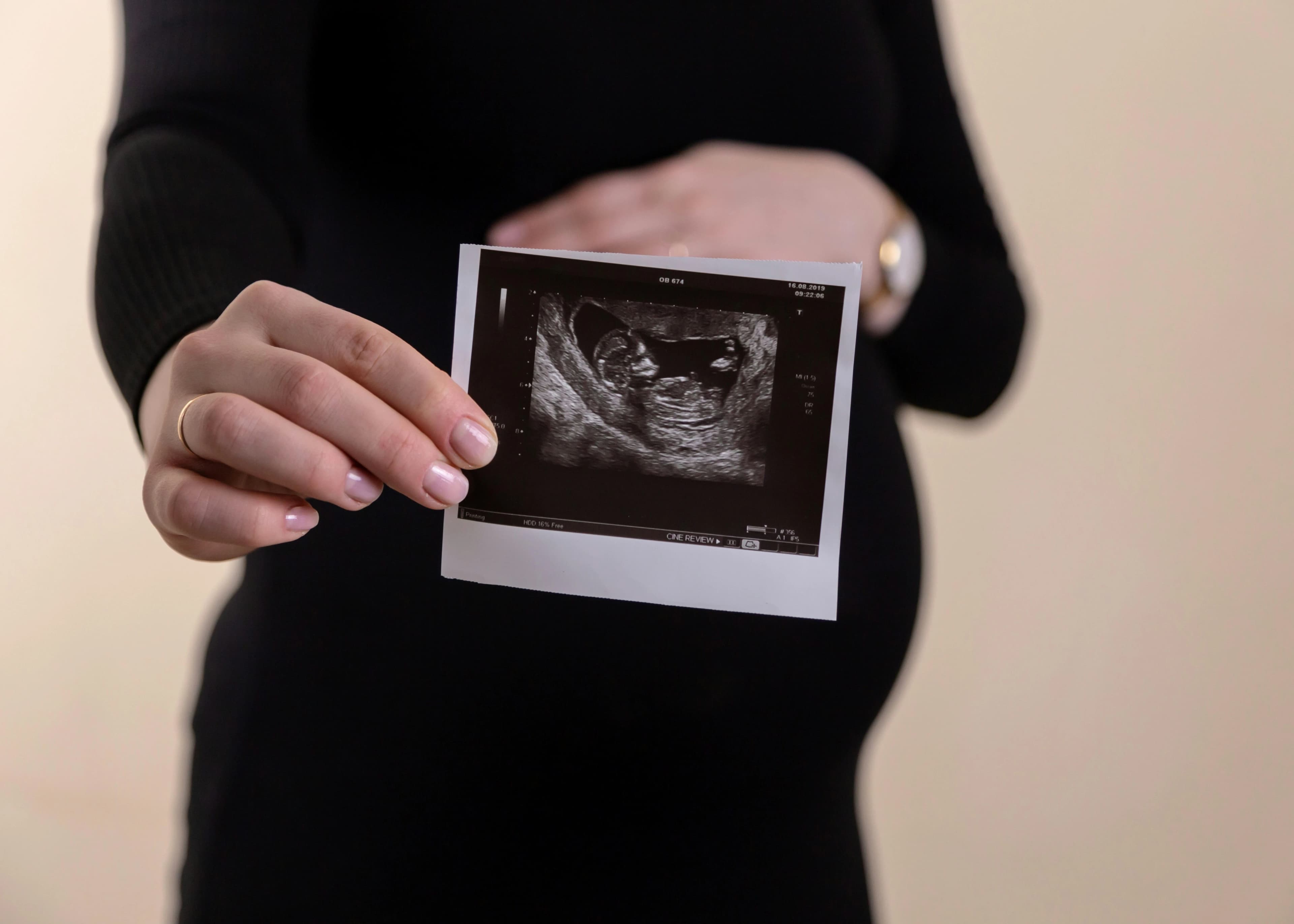 The event of a woman being pregnant